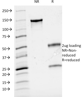Cyclin A2 (S- and G2-phase Cyclin) Antibody in SDS-PAGE (SDS-PAGE)