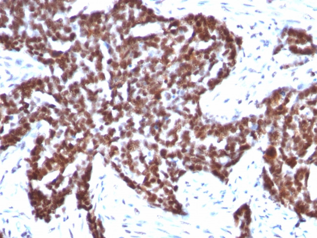 Cyclin B1 (G2- and M-phase Cyclin) Antibody in Immunohistochemistry (Paraffin) (IHC (P))