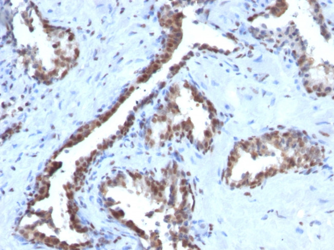 Cyclin B1 (G2- and M-phase Cyclin) Antibody in Immunohistochemistry (Paraffin) (IHC (P))