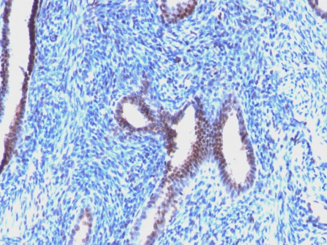 Cyclin B1 (G2- and M-phase Cyclin) Antibody in Immunohistochemistry (Paraffin) (IHC (P))