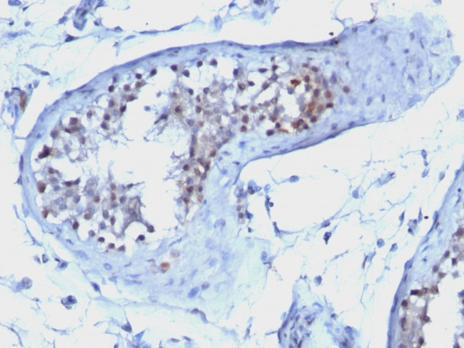 Cyclin B1 (G2- and M-phase Cyclin) Antibody in Immunohistochemistry (Paraffin) (IHC (P))