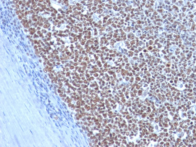 Cyclin B1 (G2- and M-phase Cyclin) Antibody in Immunohistochemistry (Paraffin) (IHC (P))