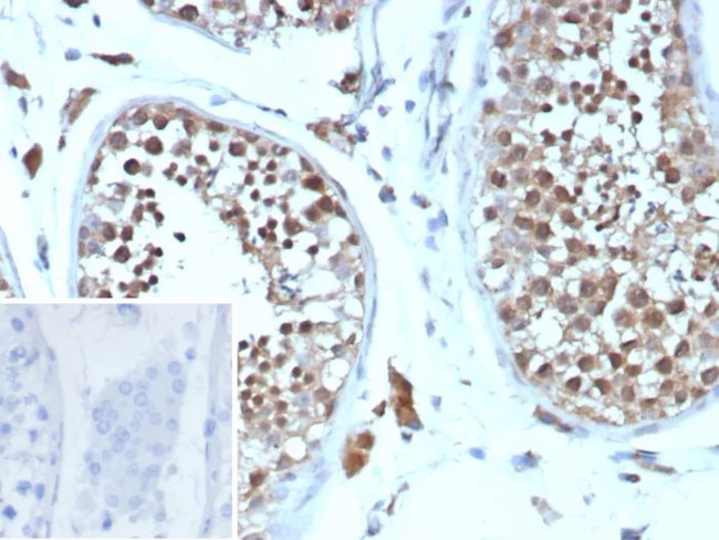 Cyclin B1 (G2- and M-phase Cyclin) Antibody in Immunohistochemistry (Paraffin) (IHC (P))