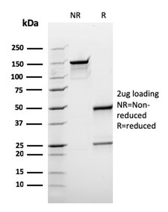 BCL10 Antibody in SDS-PAGE (SDS-PAGE)