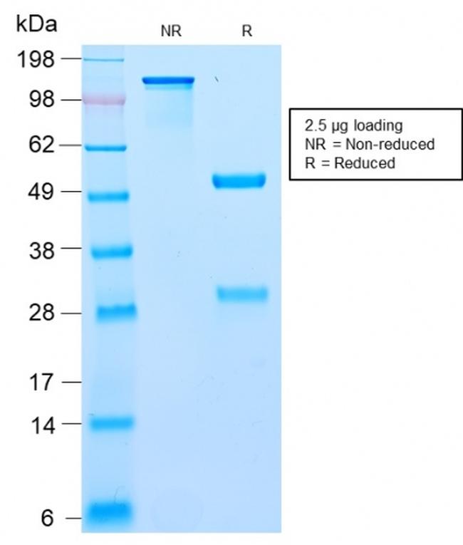 BCL10 Antibody in SDS-PAGE (SDS-PAGE)