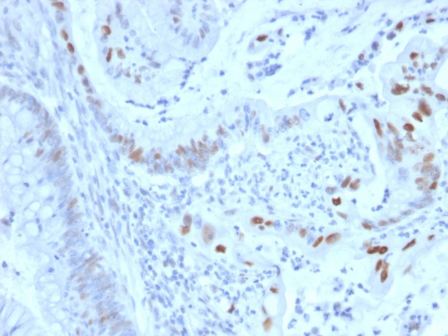 Cyclin E (G1/S-Phase Cyclin) Antibody in Immunohistochemistry (Paraffin) (IHC (P))