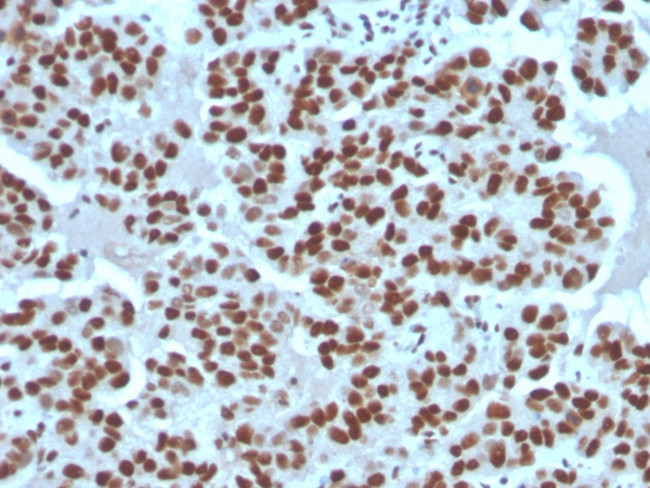 Cyclin E (G1/S-Phase Cyclin) Antibody in Immunohistochemistry (Paraffin) (IHC (P))