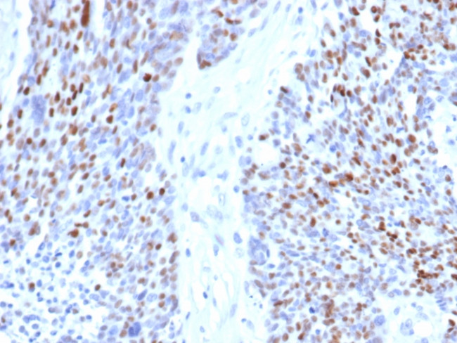 Cyclin E (G1/S-Phase Cyclin) Antibody in Immunohistochemistry (Paraffin) (IHC (P))