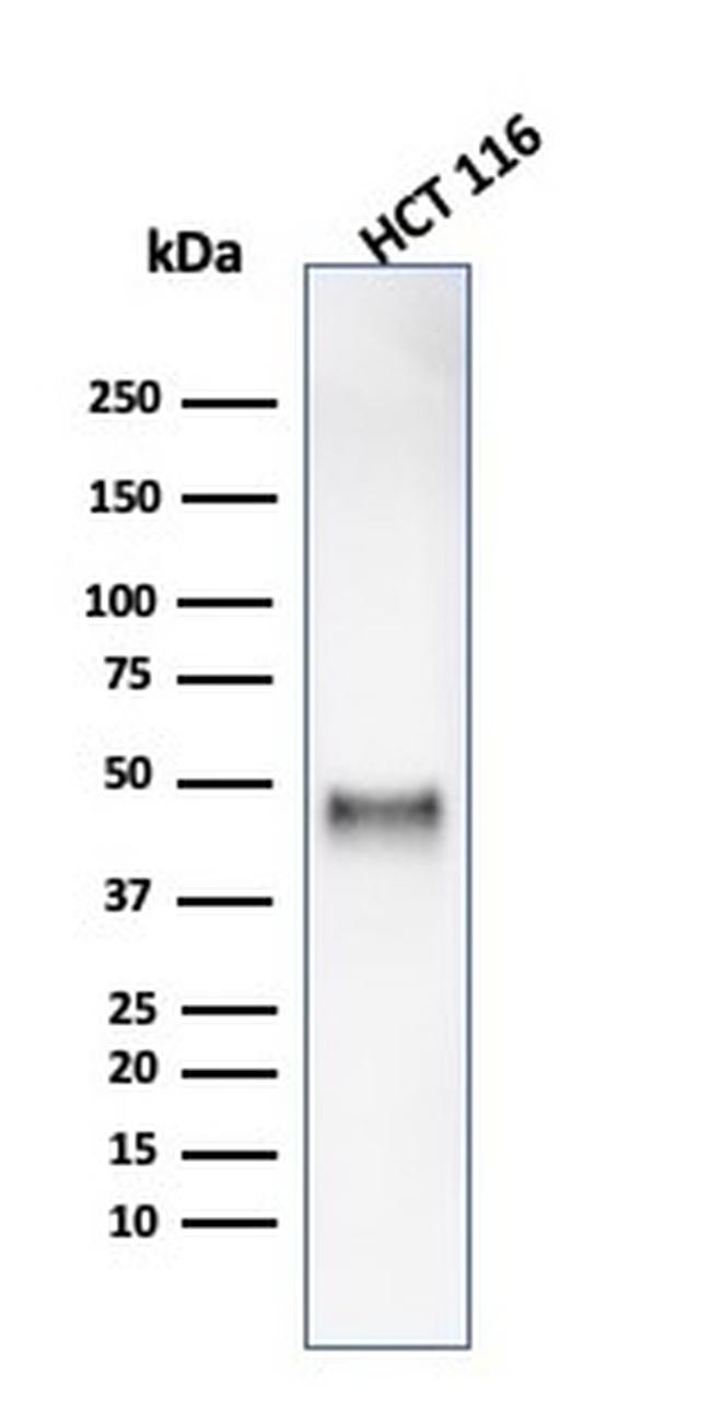 Cyclin E (G1/S-Phase Cyclin) Antibody in Western Blot (WB)