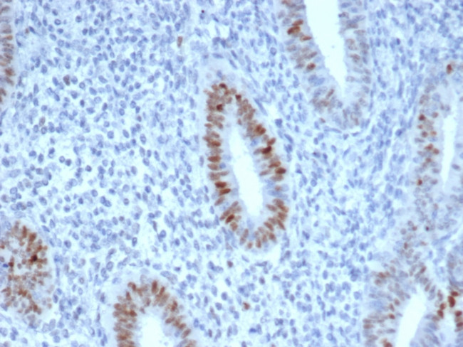 Cyclin E (G1/S-Phase Cyclin) Antibody in Immunohistochemistry (Paraffin) (IHC (P))