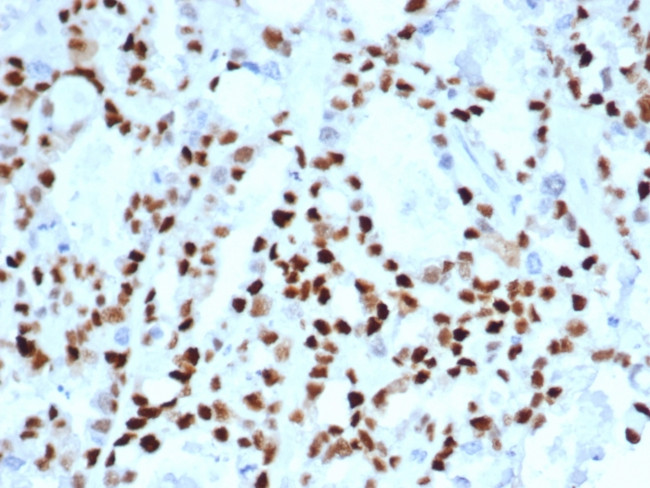 Cyclin E (G1/S-Phase Cyclin) Antibody in Immunohistochemistry (Paraffin) (IHC (P))