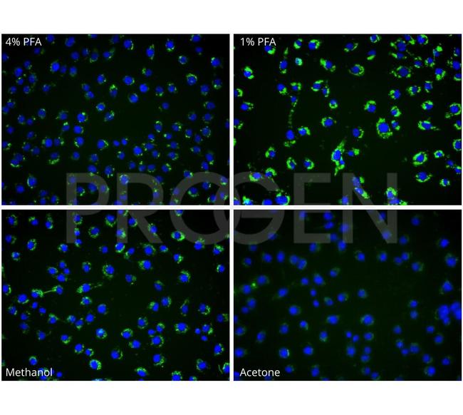 Yersinia enterocolitica O:9 Antibody in Immunocytochemistry (ICC/IF)