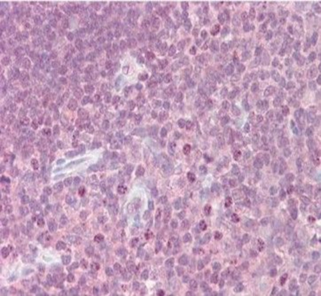 Cytokine Receptor-Like Factor 2 Antibody in Immunohistochemistry (Paraffin) (IHC (P))