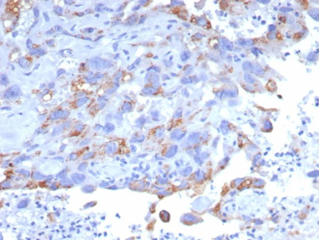 GPRC5A/PEIG-1/RAI3/RAIG1/TIG1 Antibody in Immunohistochemistry (Paraffin) (IHC (P))