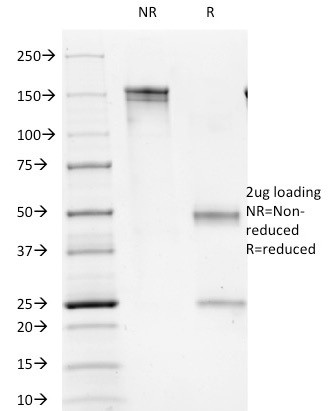 CD1b (T-Cell Surface Glycoprotein) Antibody in SDS-PAGE (SDS-PAGE)