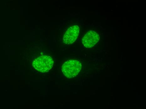 Histone H3K9ac Antibody in Immunocytochemistry (ICC/IF)