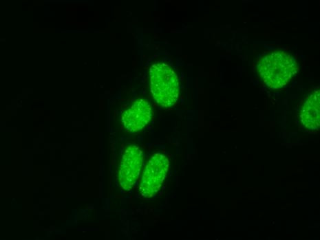 Histone H4K20me3 Antibody in Immunocytochemistry (ICC/IF)