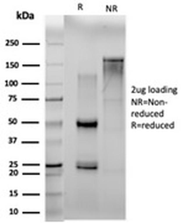 N myc (and STAT) Interactor/NMI Antibody in SDS-PAGE (SDS-PAGE)