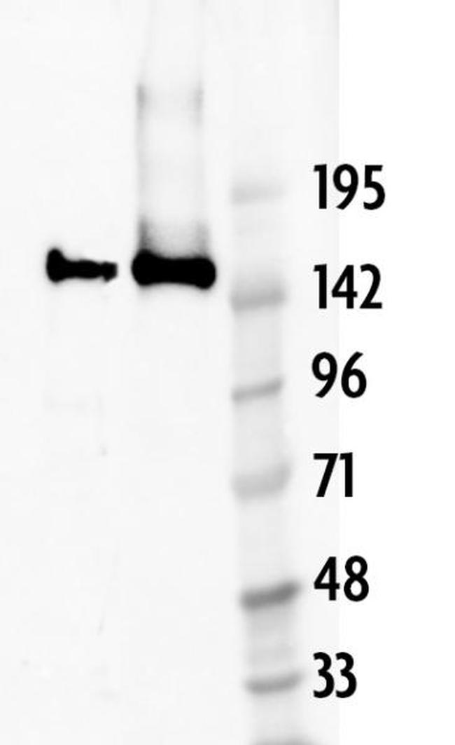 Cas9 Antibody in Western Blot (WB)