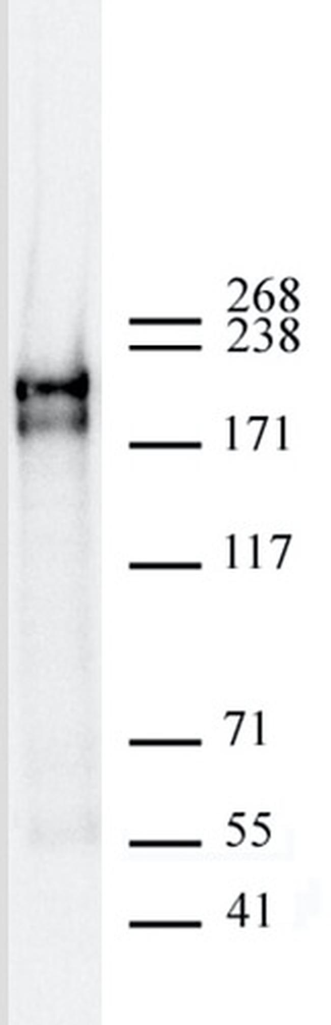 DNMT1 Antibody in Western Blot (WB)