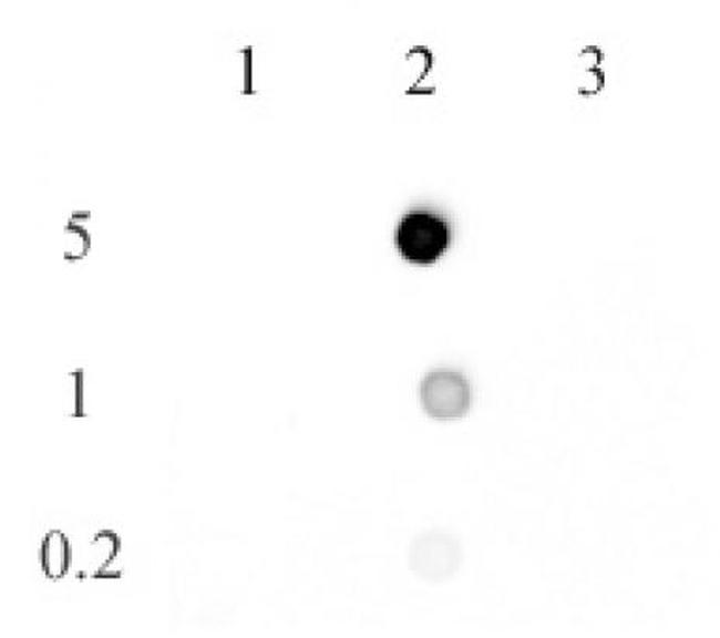 5-methylcytosine Antibody in Dot Blot (DB)