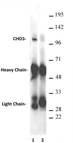 CHD3 Antibody in Immunoprecipitation (IP)