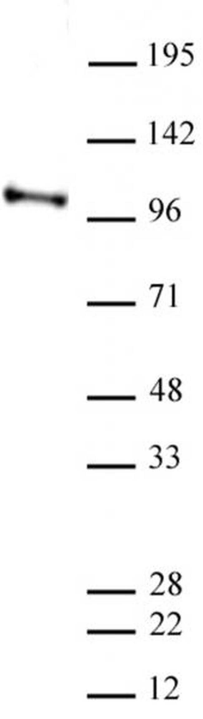 CHD3 Antibody in Western Blot (WB)