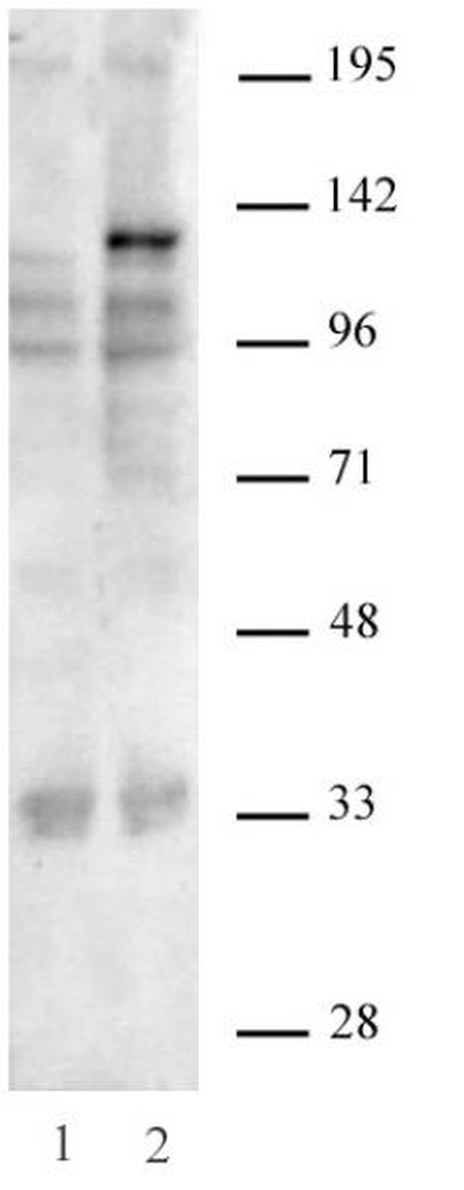 SaCas9 Antibody in Western Blot (WB)