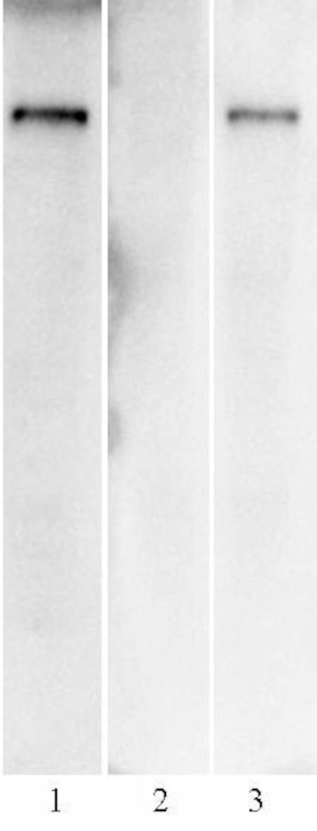 SARS-CoV-2 Spike Antibody in Western Blot (WB)