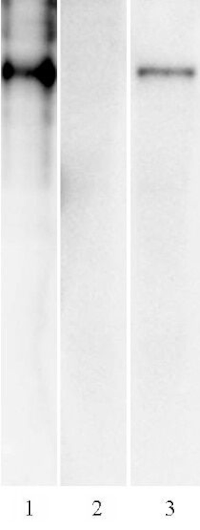 SARS-CoV-2 Spike Antibody in Western Blot (WB)