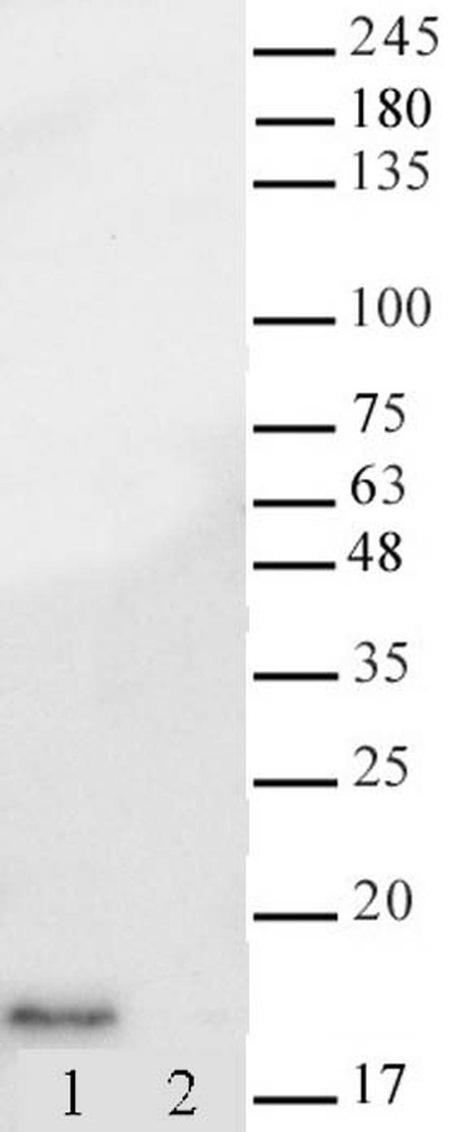 Histone H3K14ac Antibody in Western Blot (WB)