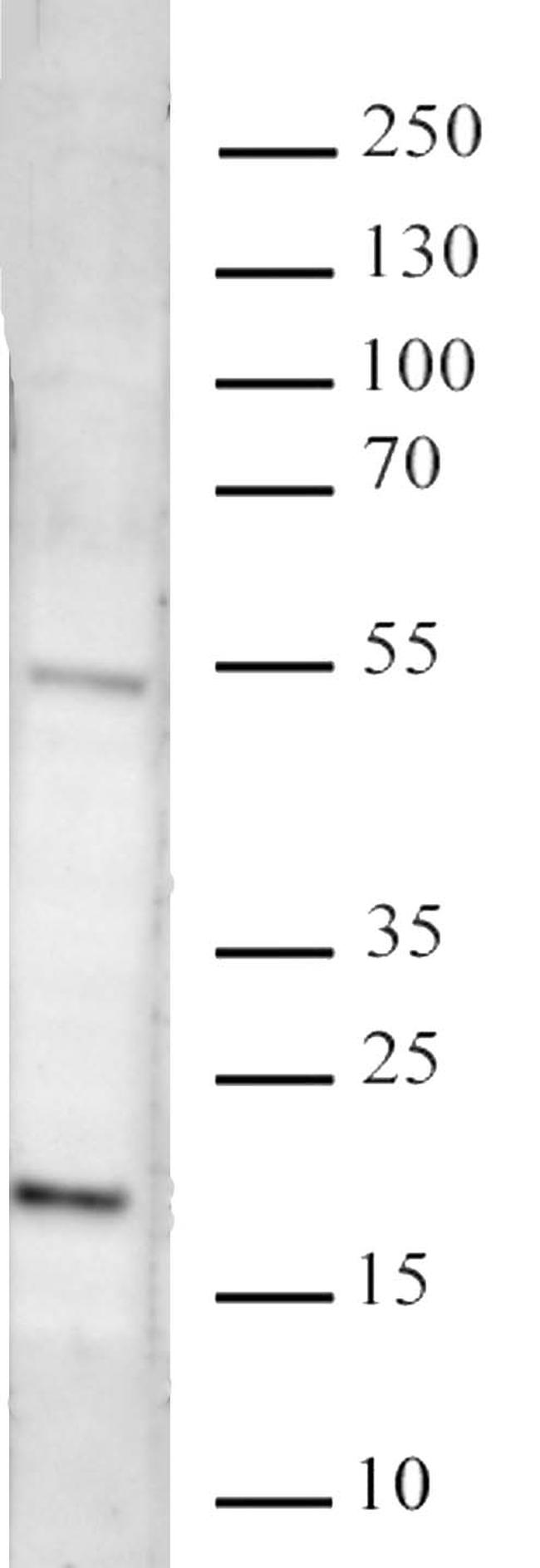 Histone H3K27me3 Antibody in Western Blot (WB)