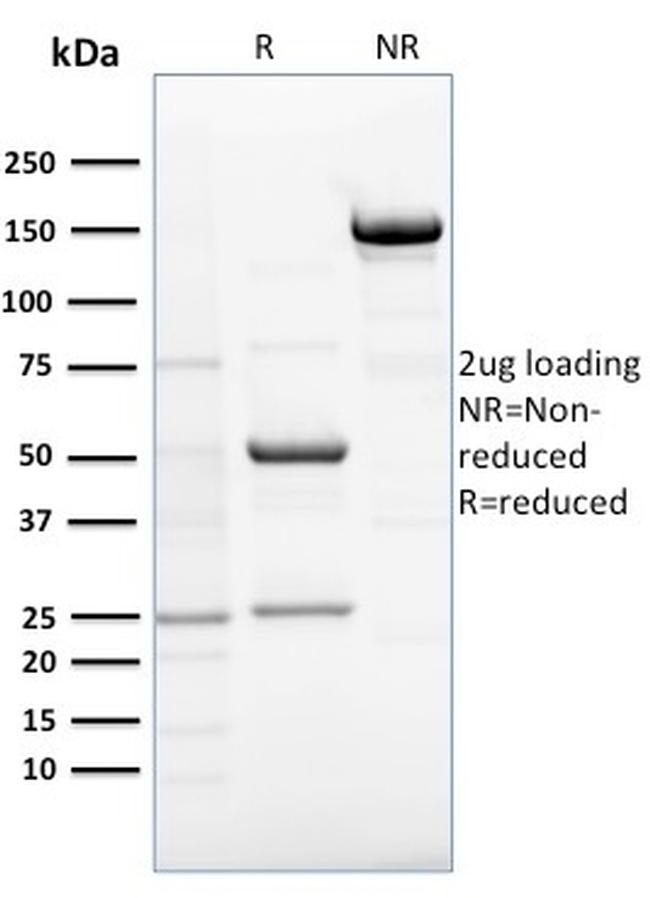 RCAS1/Estrogen Receptor Binding Site Associated, Antigen 9 Antibody in SDS-PAGE (SDS-PAGE)