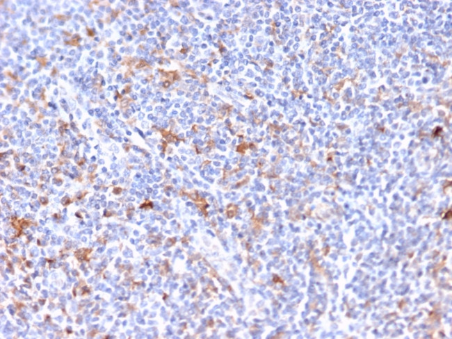 RCAS1/Estrogen Receptor Binding Site Associated, Antigen 9 Antibody in Immunohistochemistry (Paraffin) (IHC (P))