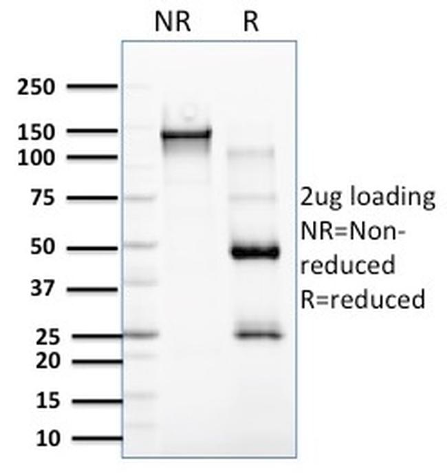 RCAS1/Estrogen Receptor Binding Site Associated, Antigen 9 Antibody in SDS-PAGE (SDS-PAGE)