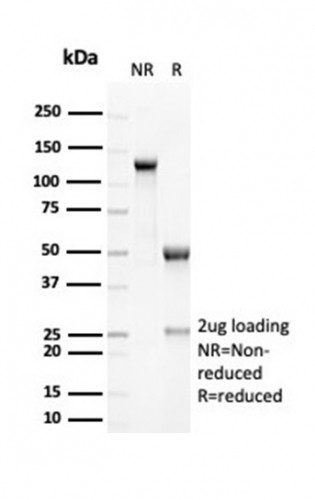 RCAS1/Estrogen Receptor Binding Site Associated, Antigen 9 Antibody in SDS-PAGE (SDS-PAGE)