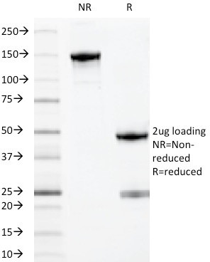 Myeloid-Associated Differentiation Marker (MYADM) Antibody in SDS-PAGE (SDS-PAGE)