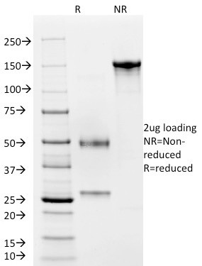 CD4 (T-Helper/Inducer Cell Marker) Antibody in SDS-PAGE (SDS-PAGE)