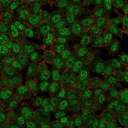 ZMYM3 Antibody in Immunocytochemistry (ICC/IF)