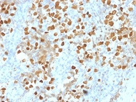 ZMYM3 Antibody in Immunohistochemistry (Paraffin) (IHC (P))