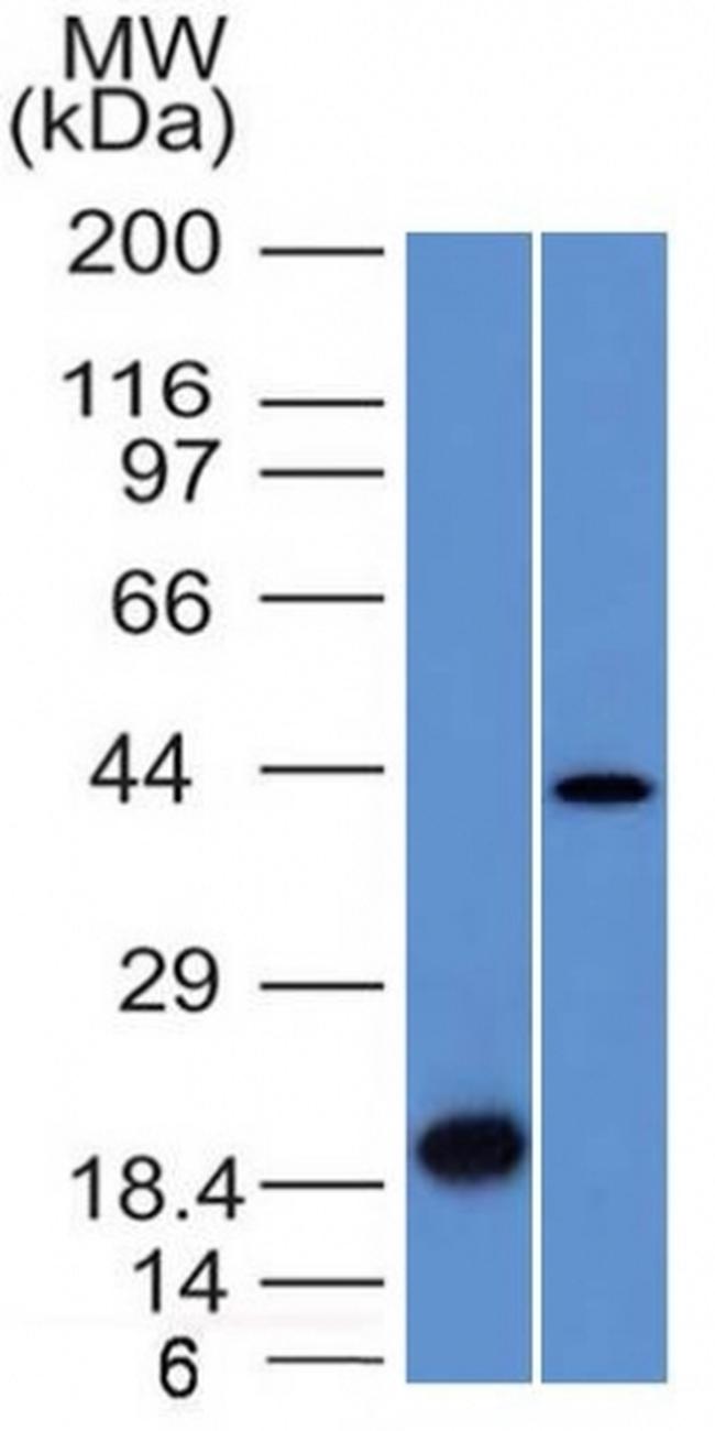 Aurora B Antibody in Western Blot (WB)