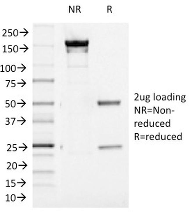 Aurora B Antibody in SDS-PAGE (SDS-PAGE)