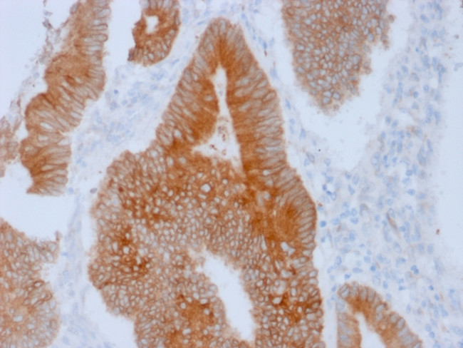 Aurora B (Proliferation Marker) Antibody in Immunohistochemistry (Paraffin) (IHC (P))