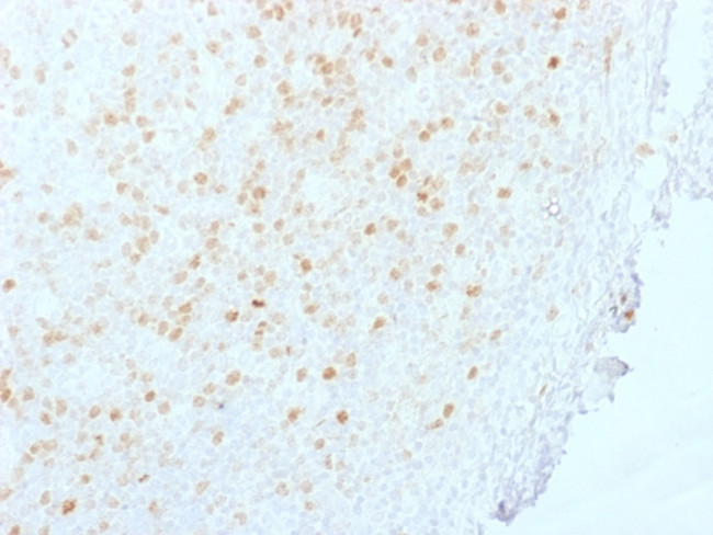 Aurora B (Proliferation Marker) Antibody in Immunohistochemistry (Paraffin) (IHC (P))