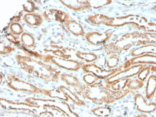 Aurora B (Proliferation Marker) Antibody in Immunohistochemistry (Paraffin) (IHC (P))