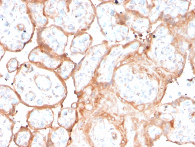 Aurora B (Proliferation Marker) Antibody in Immunohistochemistry (Paraffin) (IHC (P))