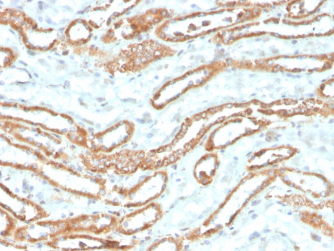 Aurora B (Proliferation Marker) Antibody in Immunohistochemistry (Paraffin) (IHC (P))