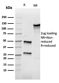 Aurora B (Proliferation Marker) Antibody in SDS-PAGE (SDS-PAGE)