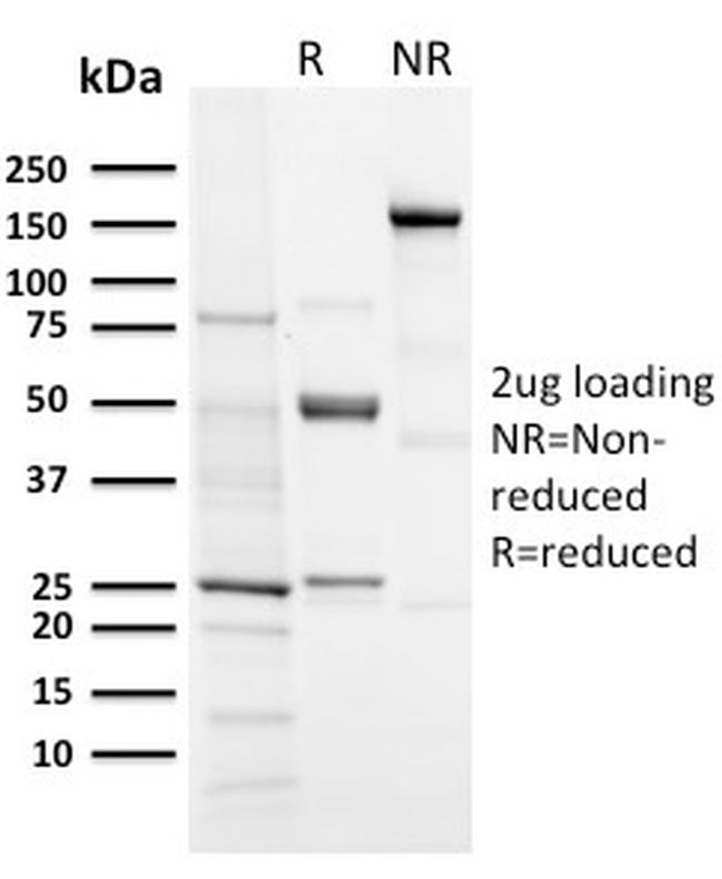 Aurora B Antibody in SDS-PAGE (SDS-PAGE)