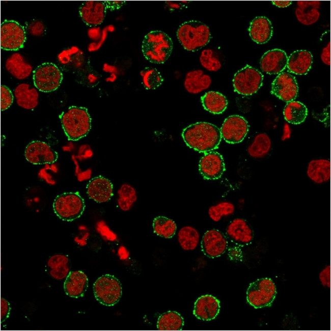 CD6 Antibody in Immunocytochemistry (ICC/IF)